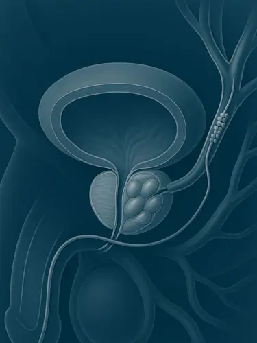 neurorradiologista intervencionista