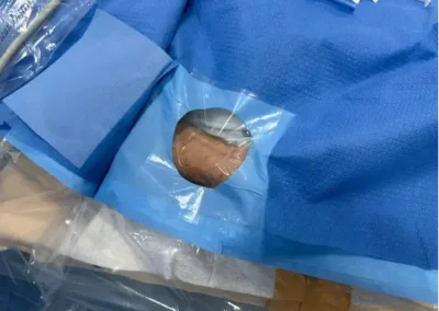 neurorradiologista intervencionista